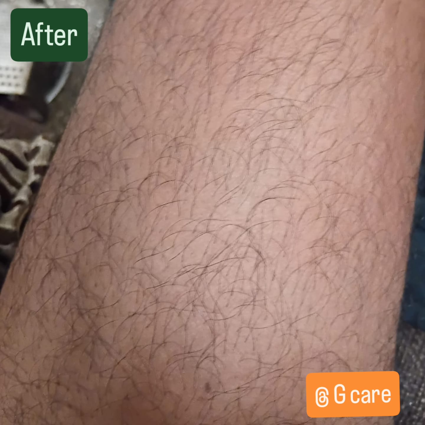 After